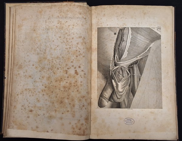 Lot 1389 - SCARPA, ANTOINE [ANTONIO]